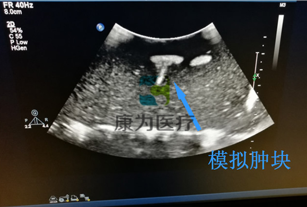 超聲引導(dǎo)下四肢血管活檢模塊